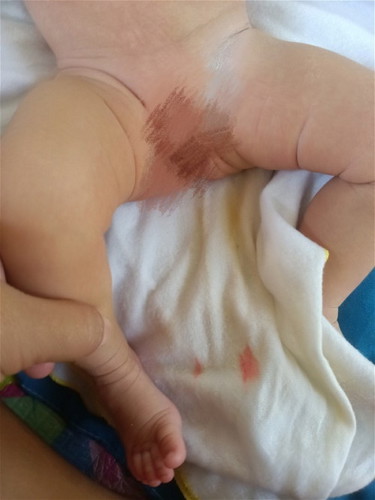 ขอสอบถามแม่ๆค่ะ น้องอายุ1 เดือน 11 วันลูกสาวค่ะ