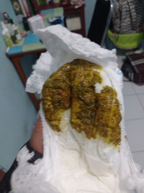 Bab bayi ada bercak darah