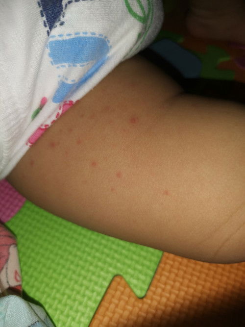 Ano po kayang pwedeng gamot sa nasa picture?