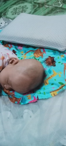 Cara mengatasi kepala bayi biar bulat gimana ya?