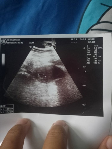 แม่ๆว่ากี่วิคคะ