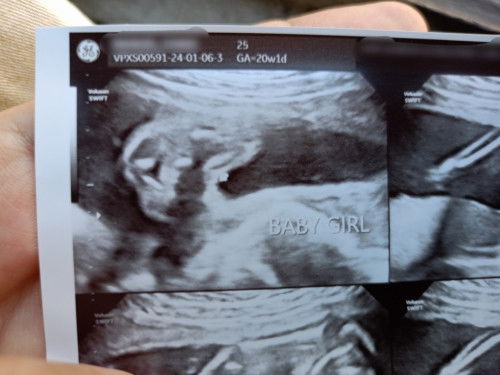 Ano po kaya gender ni baby ko?