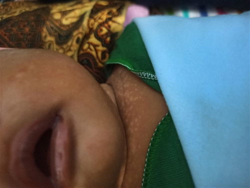 Halo mom, bekas kayak gini cara menghilangkannya gimana ya? Sharing2 dong ❤️