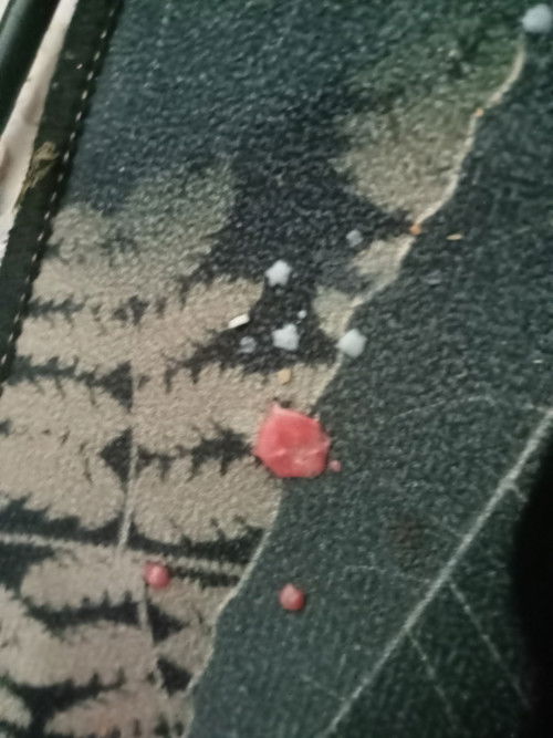 Ada ke mummy daddy alami sama mcm saya .. baby kekadang muntah susu ada keluar darah sekali .