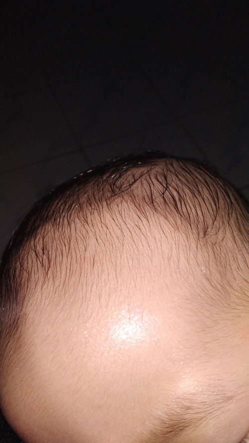 Keringetan pdhl lagi tidur