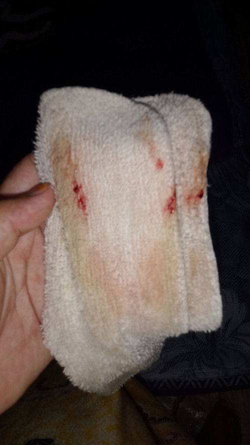 39 week keluar lendir darah