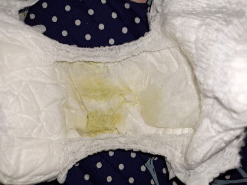 ⚠️ URINE BAYI KEHIJAUAN ⚠️