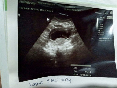 Tentang masa kehamilan