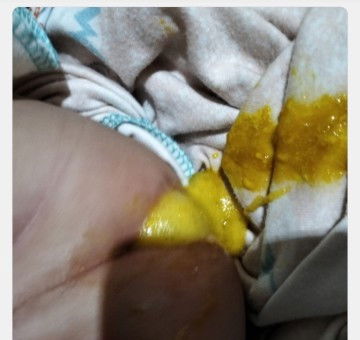 Pup bayi diare ga ya