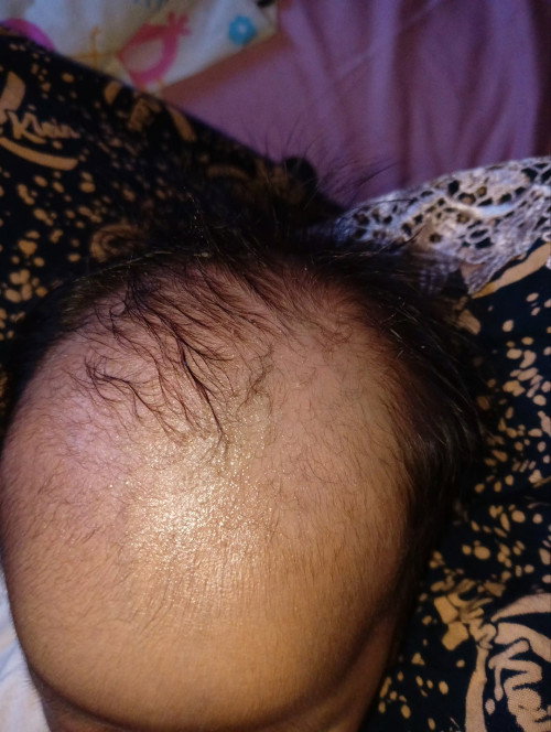 Rambut bayi