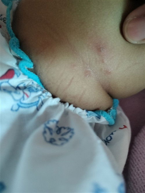 สอบถามหน่อยค่ะอาการแบบนี้ออกแนวแพ้อะไรได้บ้างค่ะหรือเพราะอาการร้อน