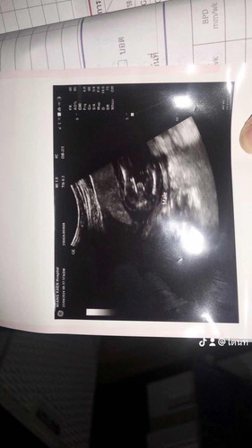 ดีใจและตื่นเต้นมาก19+4 น้องเป็นผู้ชายค่ะ