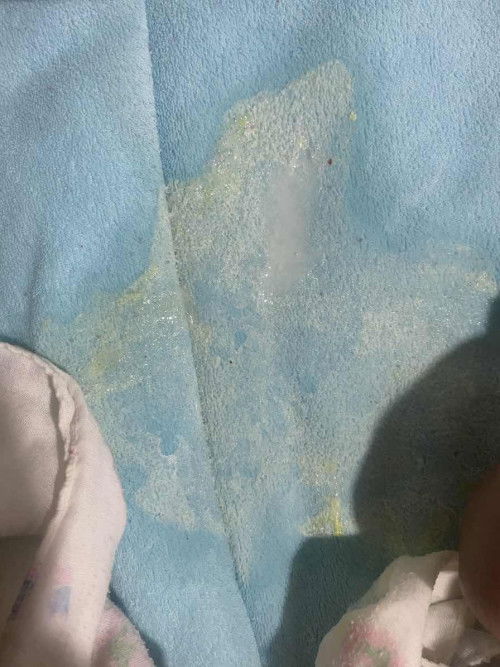 ลูกอ้วกสีเหลืองปนแบบนี้อันตรายไหมคะ