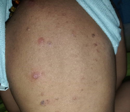 penyebab beginian kenapa ya bund