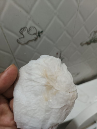 36 วีค 5 วัน มีมูกแบบนี้ ไม่มีอาการปวดท้อง ต้องไป รพ.มั้ยค่ะ