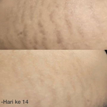 Ada yang pakai juga kah?