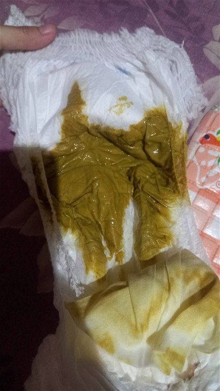 Bab diusia 4 bulan