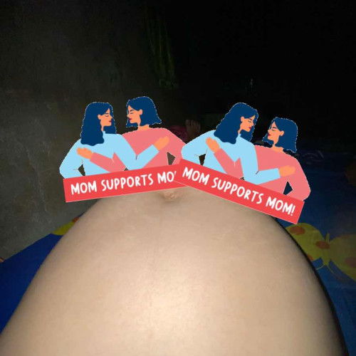 Ada yg sama ga Hamil ke 2 ga ada stretchmarks