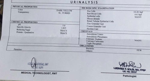 urinalysis