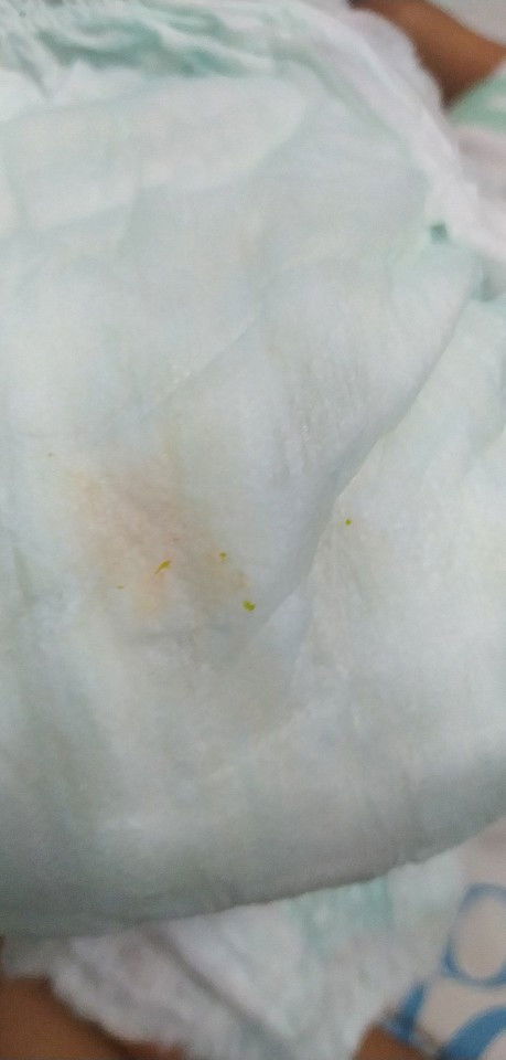 Is it normal to have orange stains in babies diaper?