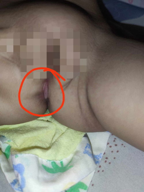 ano po kaya ito mga mommies? 
rashes po kya yan or ano po?