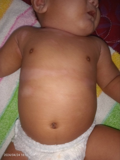 Masalah pada kulit bayi