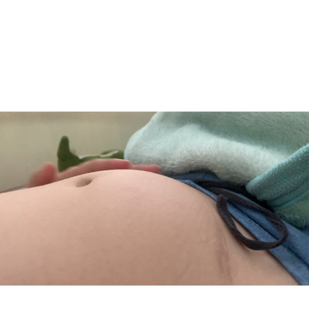 แบบนี้ท้องแข็งหรือมดลูกลอยตัวคะ