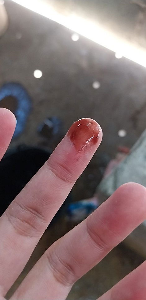 ขอคำแนะนำจากแม่ๆ