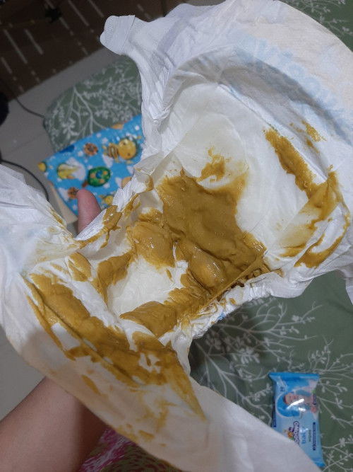 normal apa tidak pup bayi seperti ini