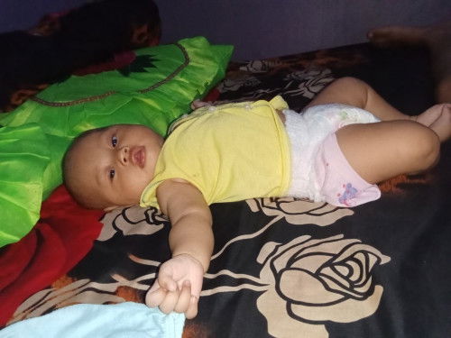 Ruam popok bayi