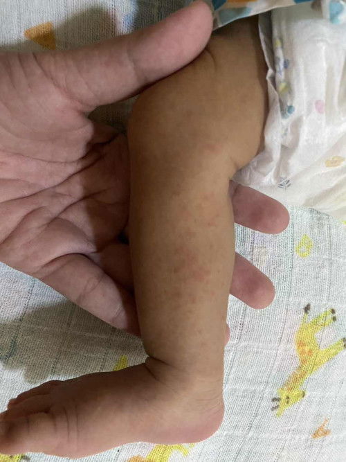 ขออนุญาตสอบถามแม่ๆหน่อยค่ะ