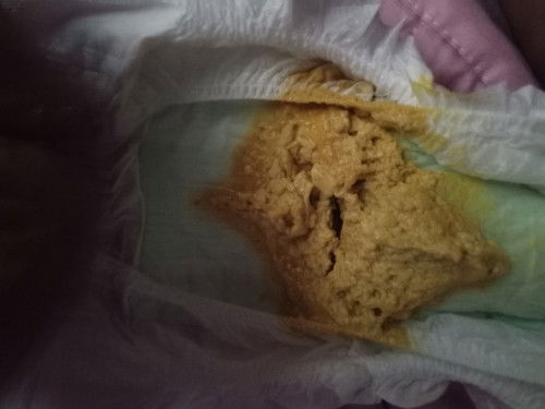 Najis baby 1bulan 12hari.