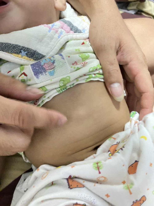 สอบถามแม่ๆท่านอื่น ที่หน้าท้องลูกกระดูดนูนขึ้นมาแบบนี้ ใต้ซีกโครงลงมานิดนึง ลูกบ้านอื่นเป็นมั้ยคะ