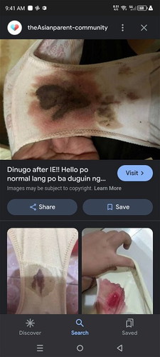 normal lang po ba mag bleed after IE? pang 2days na po 38weeks na po ako, bukas pa po check up ko eh