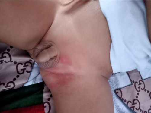 Antara popok atau air cebok yg gak cocok