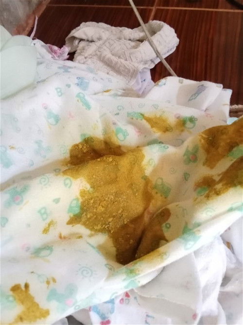 ถ่ายแบบนี้ปกติมั้ยค่ะ