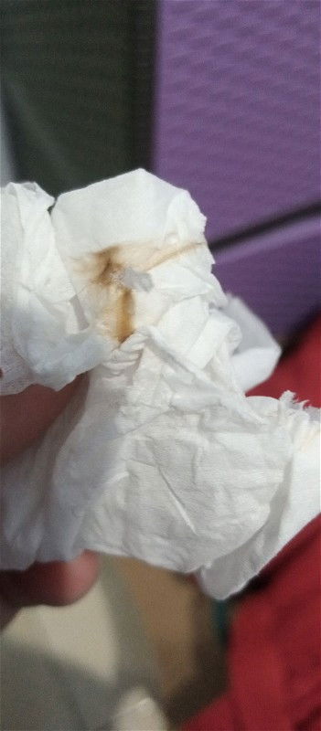 37w 6d, mulai kontraksi dan keluar lendir kecoklatan