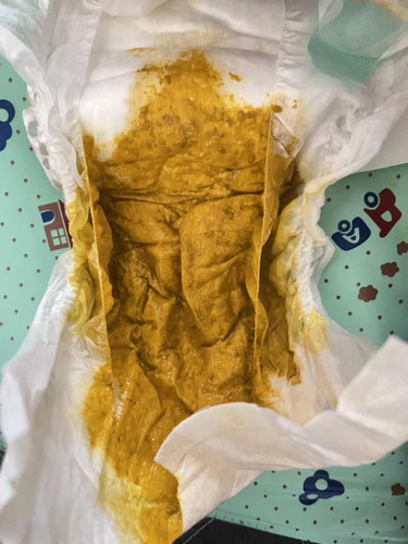 ถ่ายแบบนี้ท้องเสียมั้ยค่ะ