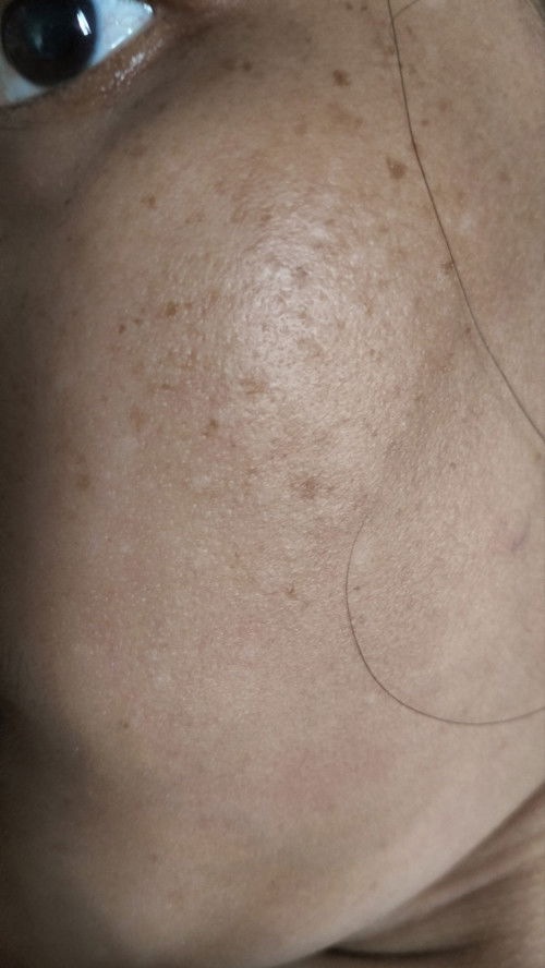 Putih putih di wajah