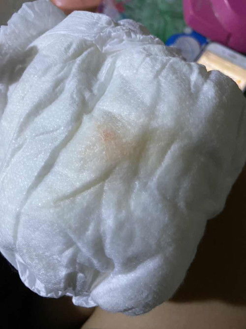 ลูกอายุ5เดือน8วันค่ะ น้องมีอาการทานนมแล้วอ้วก