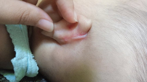 Belakang telinga bayi