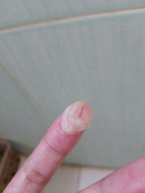 discharge or mucus plug?