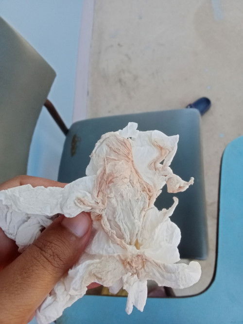 37+5wวันก่อนมีมูกสีน้ำตาล แม่บ้านไหนปวดท้องถ่ายบ่อยบ้างคะ วันนี้เข้าห้องน้ำบ่อยตอนเช้าถ่ายปกติ