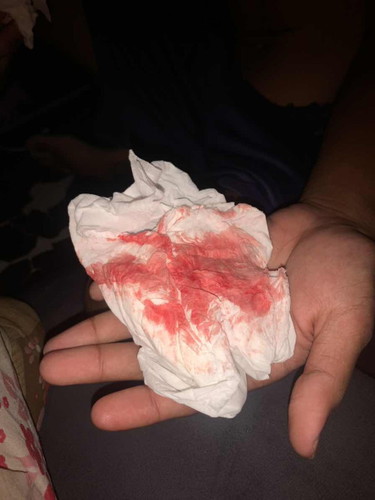 27+6 หลังมีเพศสัมพันธ์กับแฟนมีเลือดออกบริเวณช่องคลอดจะเป็นอะไรมั้ยคะ🥹