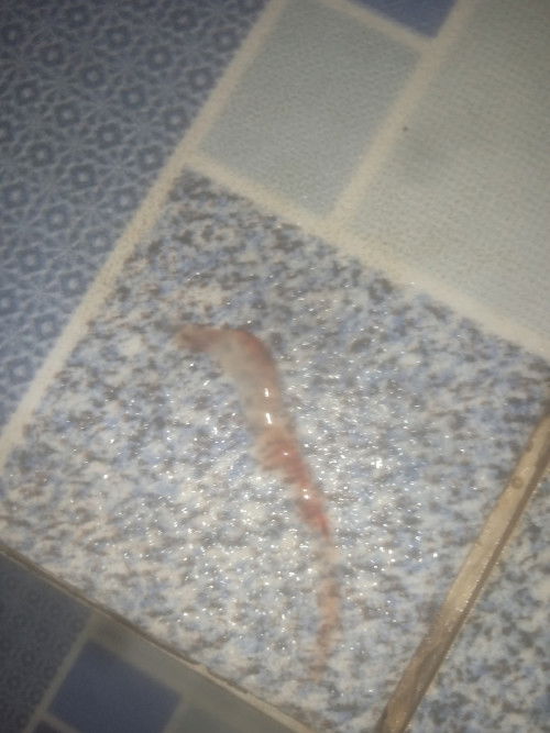 Mau tanya bun serius nih udh hawatir aja