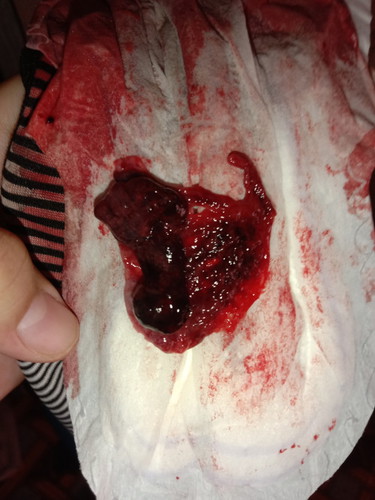 Keguguran ke apa ni..