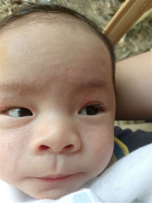 Pabalik balik na rushes at lalong kumakalat ano po kaya ang dapat gawin