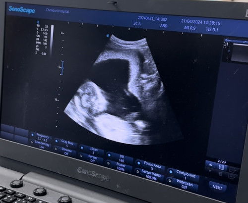 แม่ๆบ้านอื่นรู้เพศกันตอนกี่ week. บ้างคะ