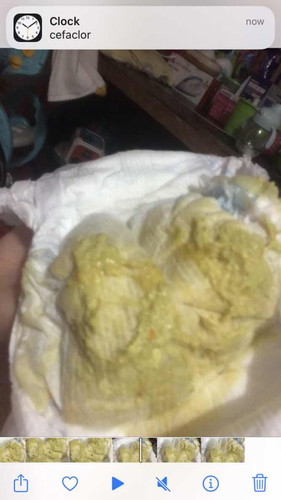 White poop ni Lo