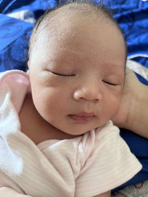 Bintik bintik pada wajah